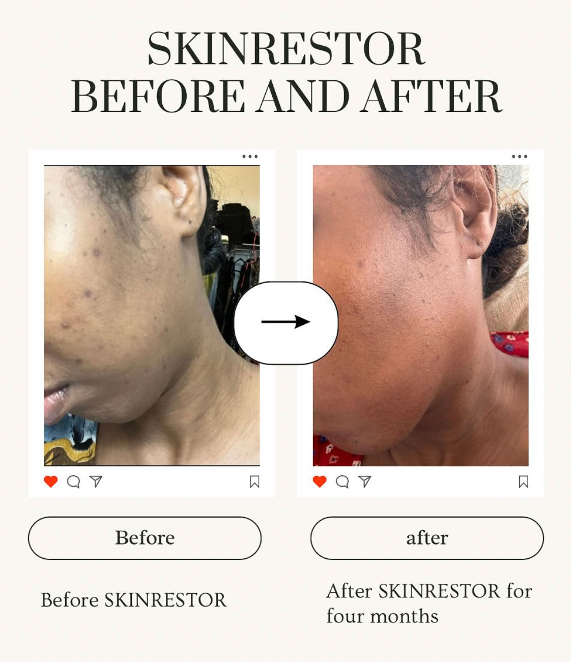 SKINRESTOR Warm VANILLA